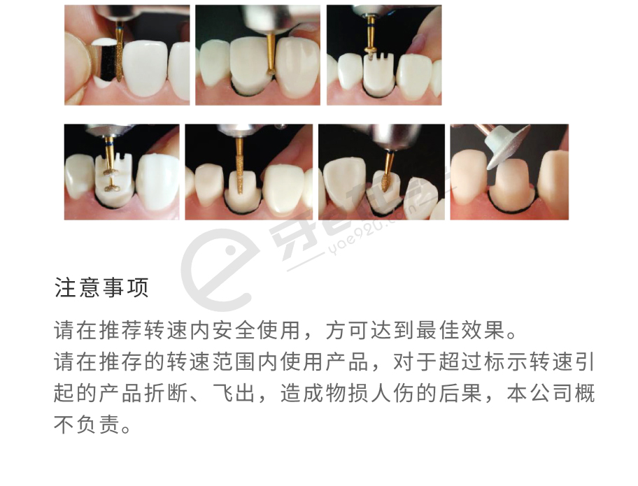 /inside/上海道邦-前牙(全瓷烤瓷)备牙套装（高速低速弯机用）FG0610D-10x1_04-1543305943786.jpeg