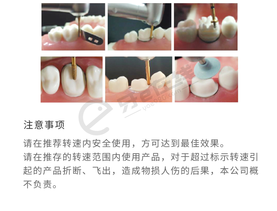 /inside/上海道邦-后牙(全瓷烤瓷)备牙套装（高速低速弯机用）FG0710D-10x1_04-1543304732219.jpeg
