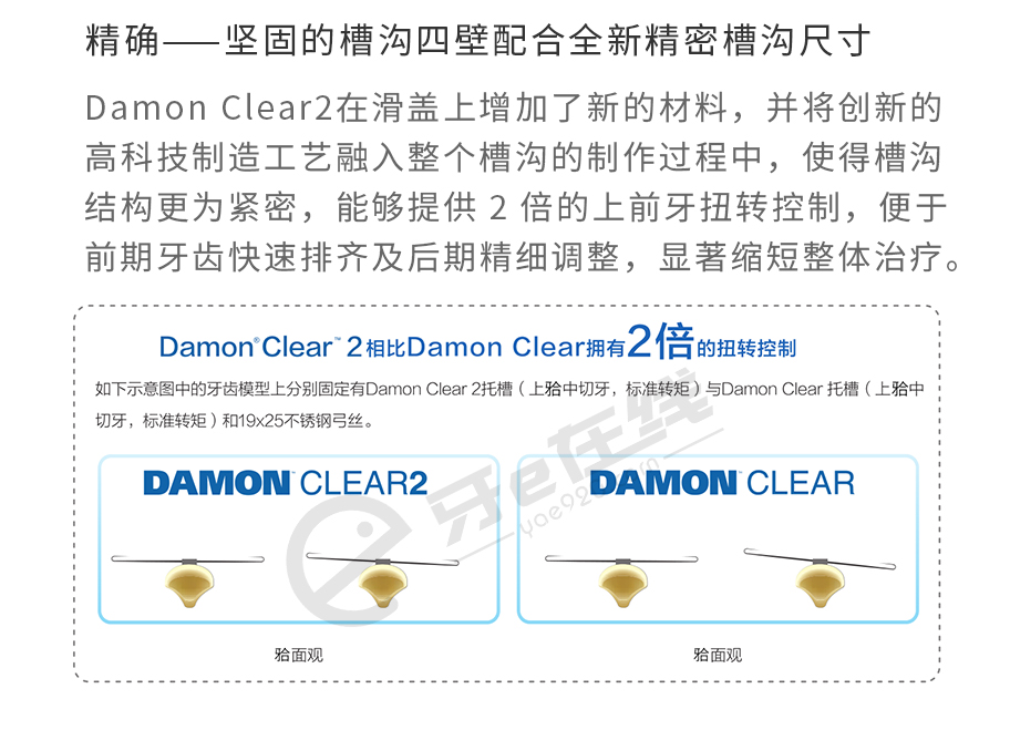/inside/奥美科Ormco-Damon™-Clear2陶瓷自锁托槽单包装_04-1545020787547.jpeg