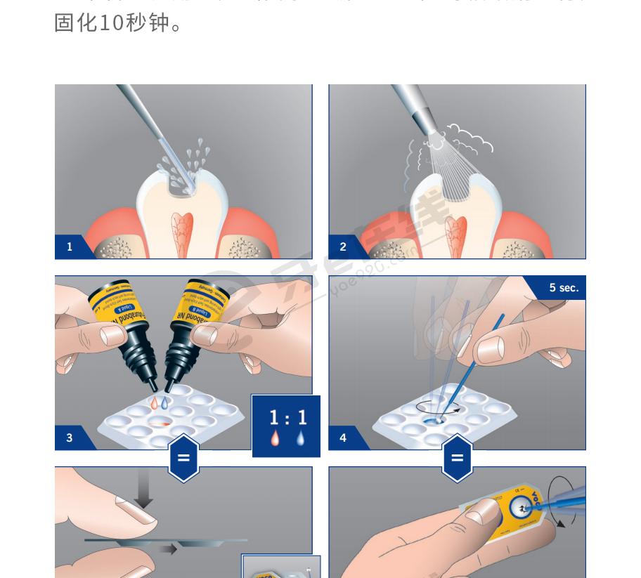/inside/德国VOCO-光固化纳米自酸蚀粘接剂_06-1527753321405.jpeg