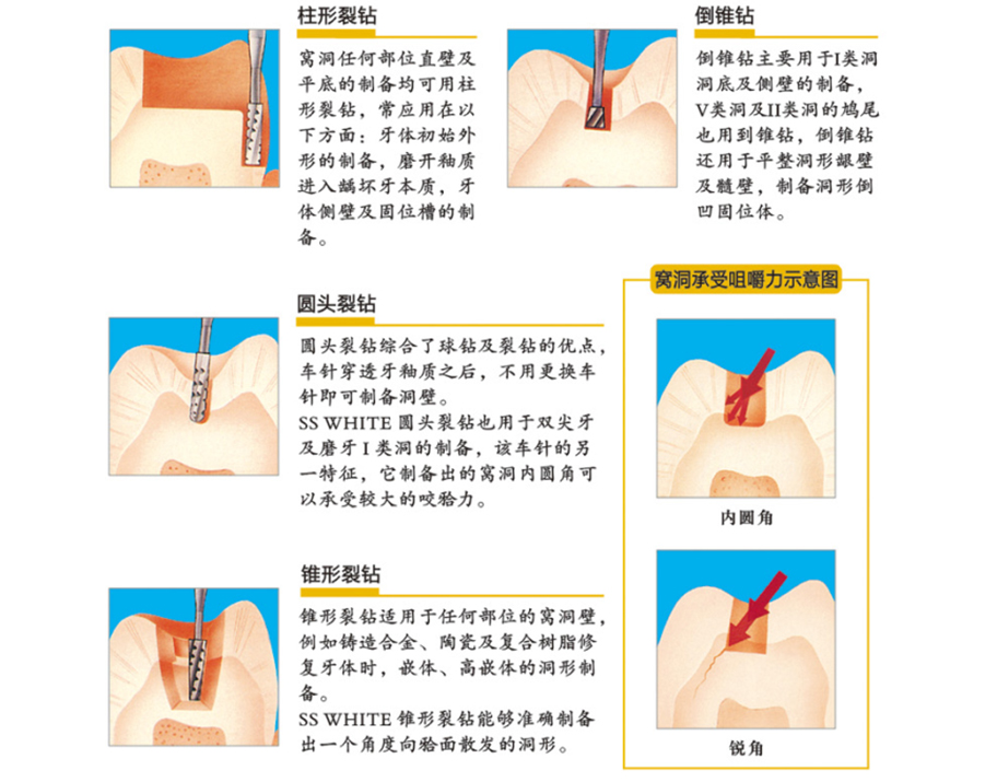 /inside/美国SSW-高速车针（倒锥钻）_05-1542164231565.jpeg